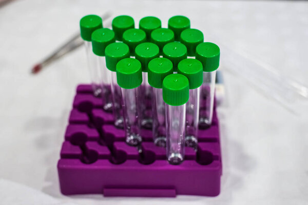 Culture of bacteria in petri dish