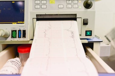 Valencia, İspanya - 25 Ekim 2018: Elektrokardiyogram bir hastanede muayene sırasında hamile bir kadın, grafikle.
