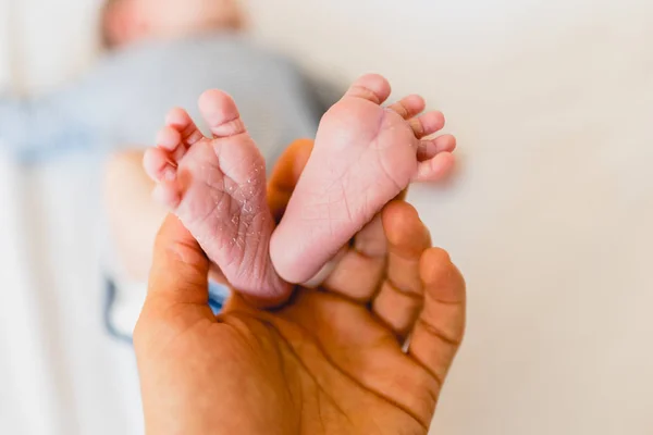 Newborn Feet Skinning Held Mommy — Stock Photo, Image