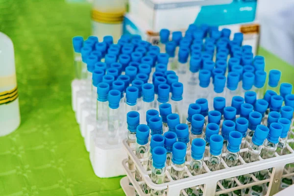 Many test tubes with blue plugs in a rack full of scientific exp — Stock Photo, Image