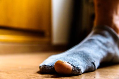 Bir adamın büyük ayak parmağı, yoksulluk kavramı bir delik ile kırık çorap d