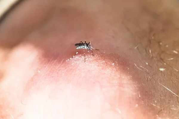 Mosquito tigre, Aedes albopictus, una plaga que aparece en la — Foto de Stock