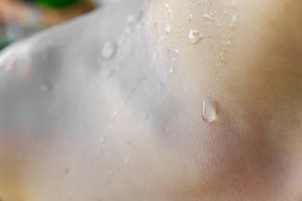 Beads Sweat Skin White Child — Stock Photo, Image