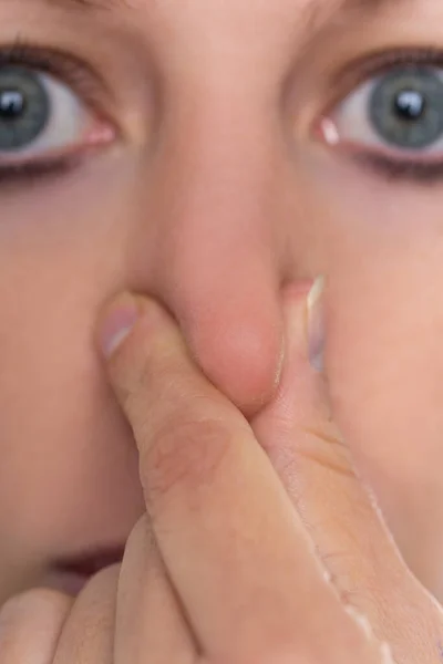 Woman Holding Her Nose Concept Anosmia Hyposma Rhinaesthesia Stench — Stock Photo, Image