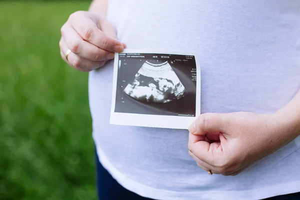 Беременная женщина держит в руках ультразвук — стоковое фото