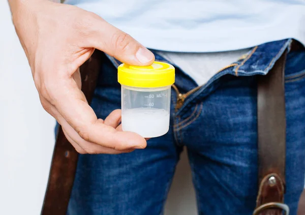 Чоловік тримає в руках контейнер зі спермою — стокове фото