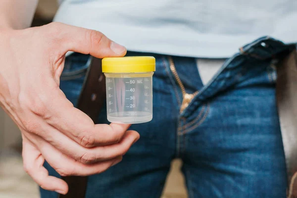 Человек держит в руках контейнер со спермой — стоковое фото