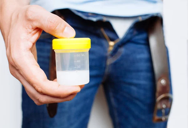 Homem segurando em mãos recipiente com esperma — Fotografia de Stock