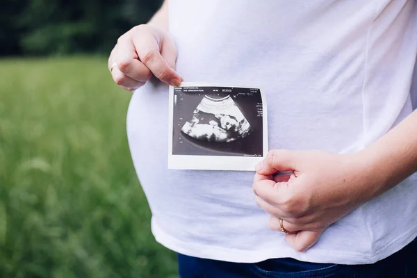 Hamile kadın ellerini tutarak ultrason fotoğraf — Stok fotoğraf