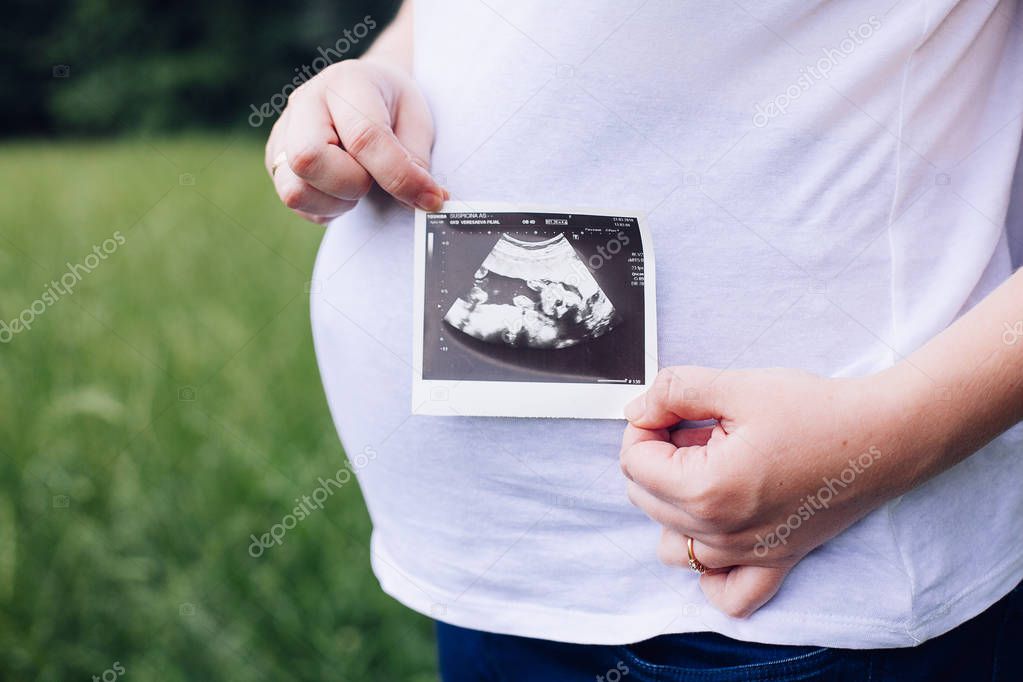 Pregnant woman hands holding ultrasound photo
