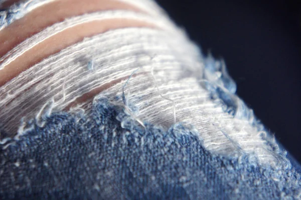 Holes on jeans, threads stick out blue jeans worn out — Stock Photo, Image