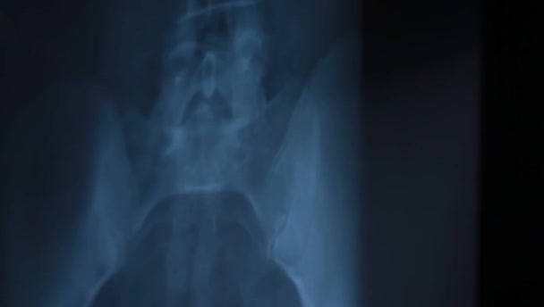 Xray Pack Sacudidas Desfoca — Vídeo de Stock