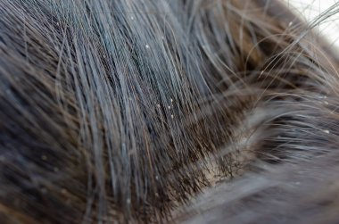 İşe yaramaz yumurta 