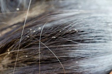 İşe yaramaz yumurta 