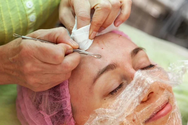 A young girl is lying on a couch during cosmetic procedures with
