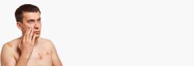 Vücudunda morluklar olan esmer adam elini başının üstüne tutar