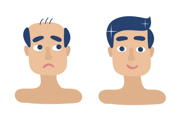 Etapas de los hombres de pérdida de cabello, tratamiento y trasplante. Ilustración vectorial — Vector de stock