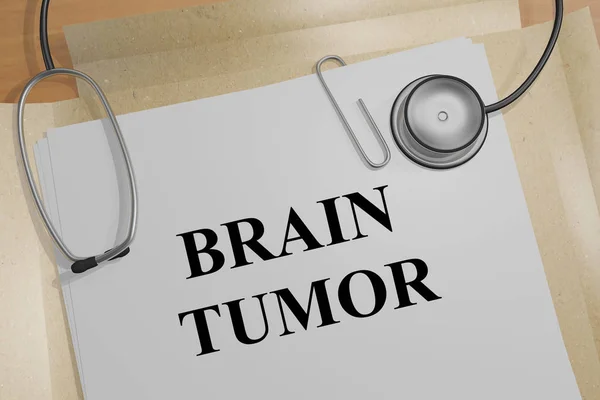 医学文献中脑肿瘤标题的图示 — 图库照片
