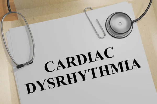 CARDIAC DYSRHYTHMIA concept — Stock Photo, Image