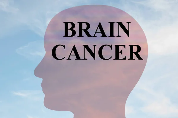 Concepto de cáncer cerebral — Foto de Stock