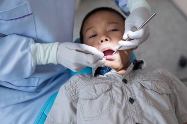 Diş hekiminin elleri diş aletini tutuyor. Hastanedeki dişçi koltuğunda yatan çocuğun dişlerini kontrol ediyorum..