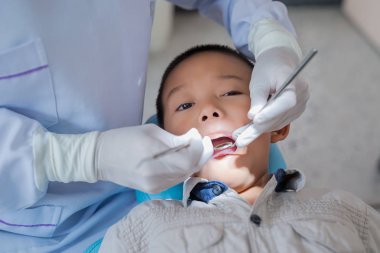 Diş hekiminin elleri diş aletini tutuyor. Hastanedeki dişçi koltuğunda yatan çocuğun dişlerini kontrol ediyorum..