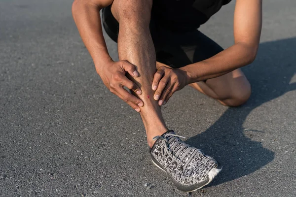 Jovem Esporte Homem Shin Lesão Corrida — Fotografia de Stock