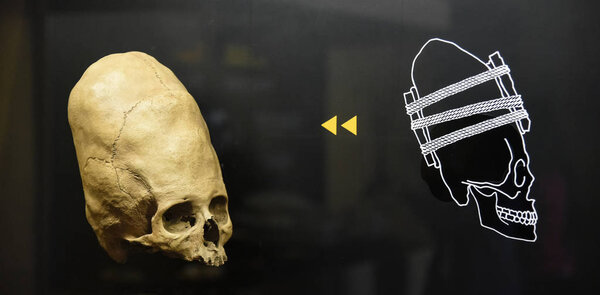 Cuzco / Peru - 07.12.2017: Deformed ancient Peruvian Skull. isolated, black background.