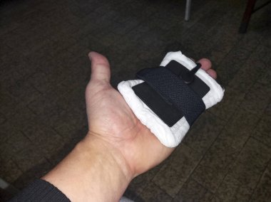 Fizik tedavi mecical klinik fizyoterapi elektrik dürtü şok tedavi el yaralanma rehabilitasyon - on için