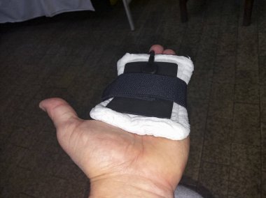 elektrotlar elektrik masaj fizyoterapi odasında. El terapi, sinir stimülasyonu - on