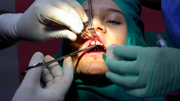 Dziewczyna Dentysty Podczas Endodontyczne Ząb Kanału Wypełnienie Aplikacji — Zdjęcie stockowe