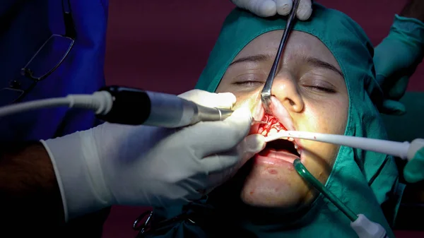 Chirurgia Stomatologiczna Dental Operacji Guma Apicoectomy Torbiel Zęba — Zdjęcie stockowe