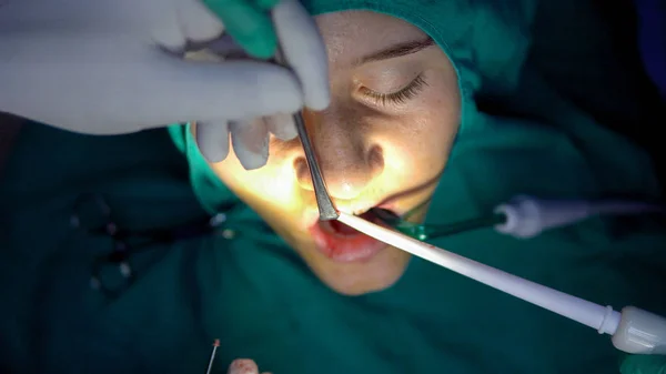 口腔外科手术 囊肿一次性加 — 图库照片