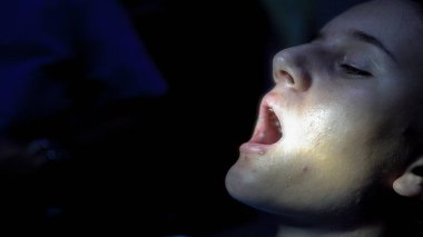 Kız dişçi Endodontik diş kanal uygulama doldurma sırasında