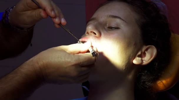 在牙医用牙镜检查牙齿的小女孩 — 图库视频影像