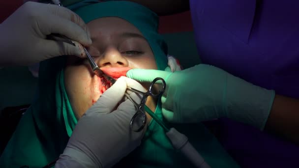 Oralchirurgie, Nähen der Wunde mit chirurgischer Nadel