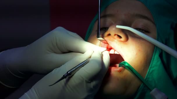 Oral Kirurgi Drift Hällkista Apikoektomi Mörka Operationssalen — Stockvideo