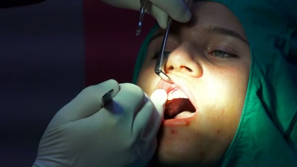 Cirugía Implantes Dentales Operación Encía Apicectomia Primer Plano — Vídeo de stock