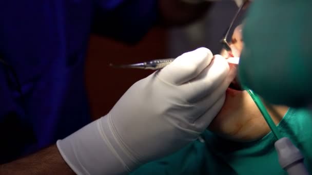 Chirurgii Jamy Ustnej Pracy Ciemne Pomieszczenia Chirurgia Światło Lampy — Wideo stockowe