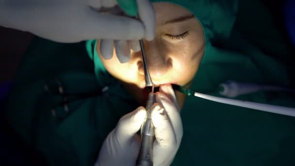 Oralchirurgie Zystenapiktomie Dunkler Operationssaal Selektiver Fokus Von Oben — Stockvideo