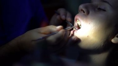 Kız endodonic sırasında diş hekimi, diş uygulama dolum chanel