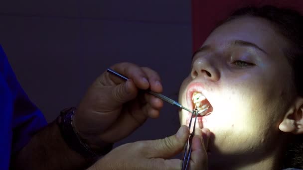 Chica Dentista Durante Aplicación Llenado Del Canal Dental Endodónico — Vídeo de stock