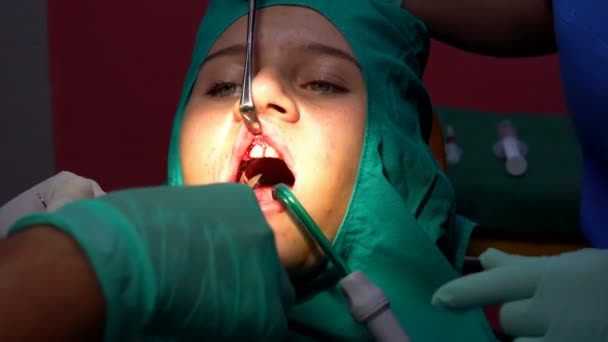 歯科口腔外科操作カット ステッチ 歯ガム Apicactomy 嚢胞の除去 — ストック動画