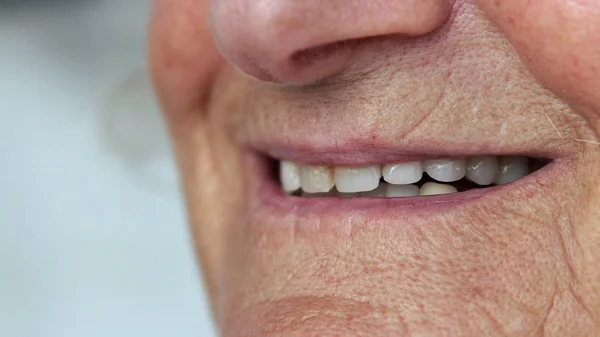 Closeup Mouth Elderly Woman Talking Smiling Perfect Teeth — Stock Photo, Image