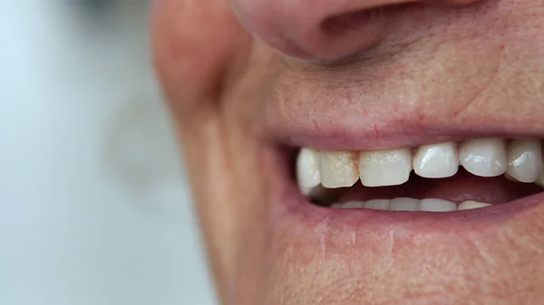 Fechar Boca Mulher Idosa Falando Sorrindo Com Dentes Perfeitos — Fotografia de Stock