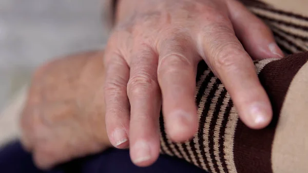Processo Envelhecimento Velha Mulher Sênior Mãos Pele Enrugada — Fotografia de Stock