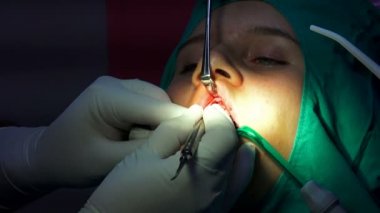Oral cerrahi operasyon, sanduka apicoectomy, karanlık operasyon odası