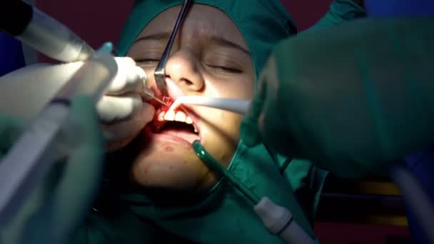 口腔外科手術 Cist 暗い操作室 — ストック動画