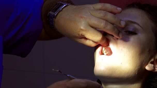 Endodonik Diş Kanalı Başvurusu Sırasında Dişçide Çalışan Bir Kız — Stok video