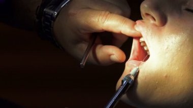 Diş hekimi uygulamak oral cerrahi operasyon, closeup öncesi anestezik enjeksiyon